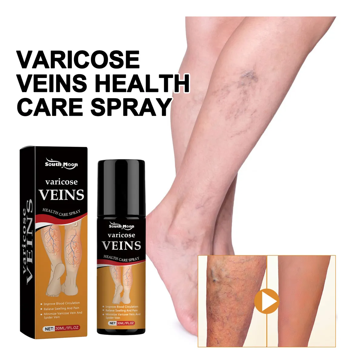 Turmeric Varicose Veins Relief Spray - (Buy 1 Get 1 FREE🔥🔥)