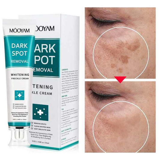 MOOYAM Korean Whitening & Melasma Cream- (Buy 1 Get 1 FREE)