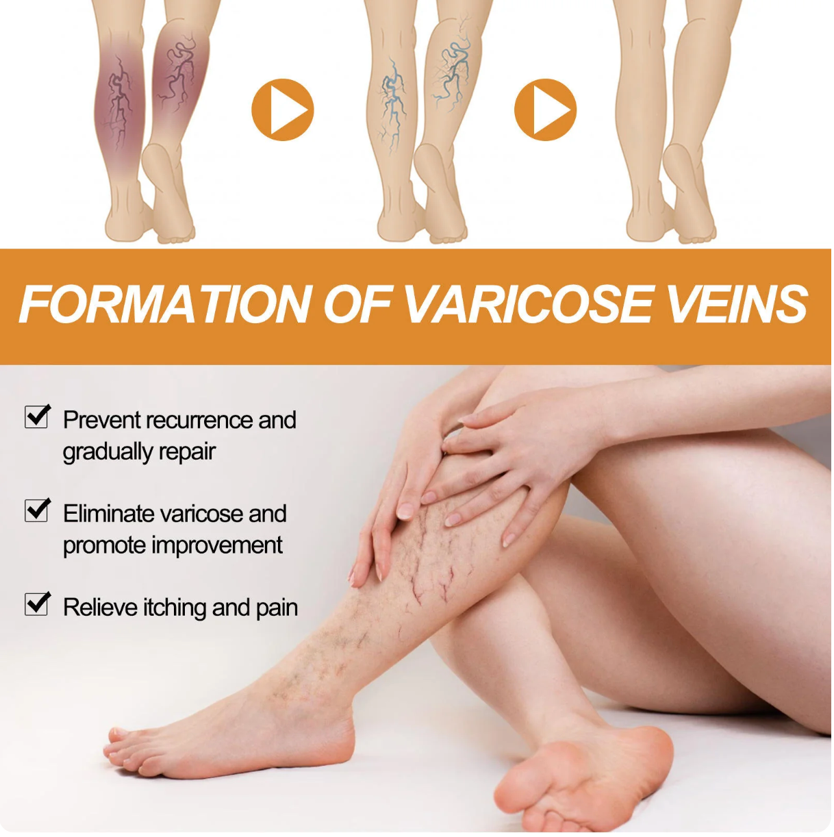 Varicose Veins Relief Herbal Spray - (Buy 1 Get 1 FREE🔥🔥)