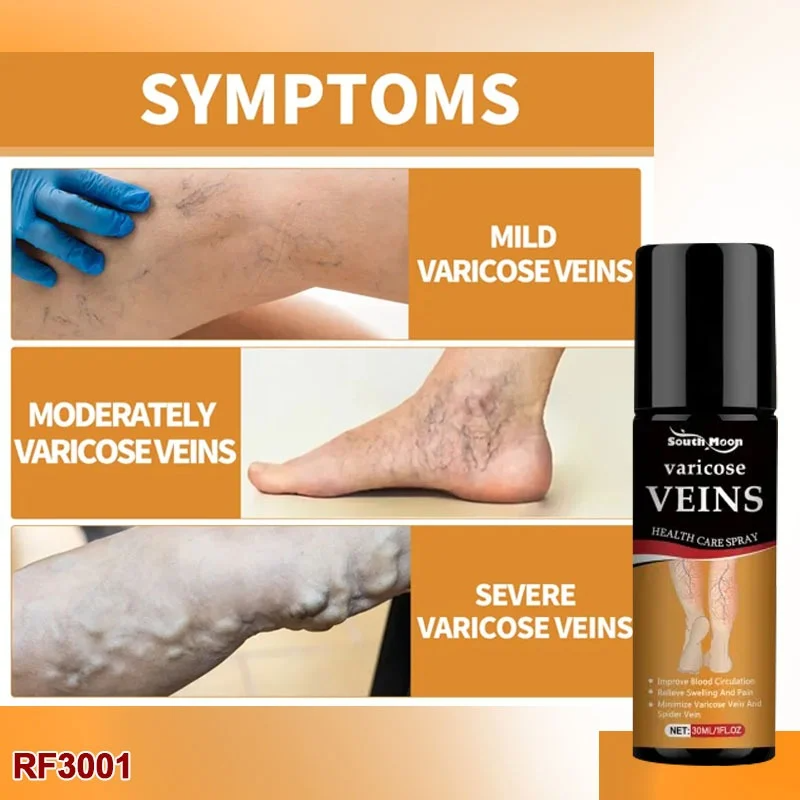 Varicose Veins Relief Herbal Spray - (Buy 1 Get 1 FREE🔥🔥)